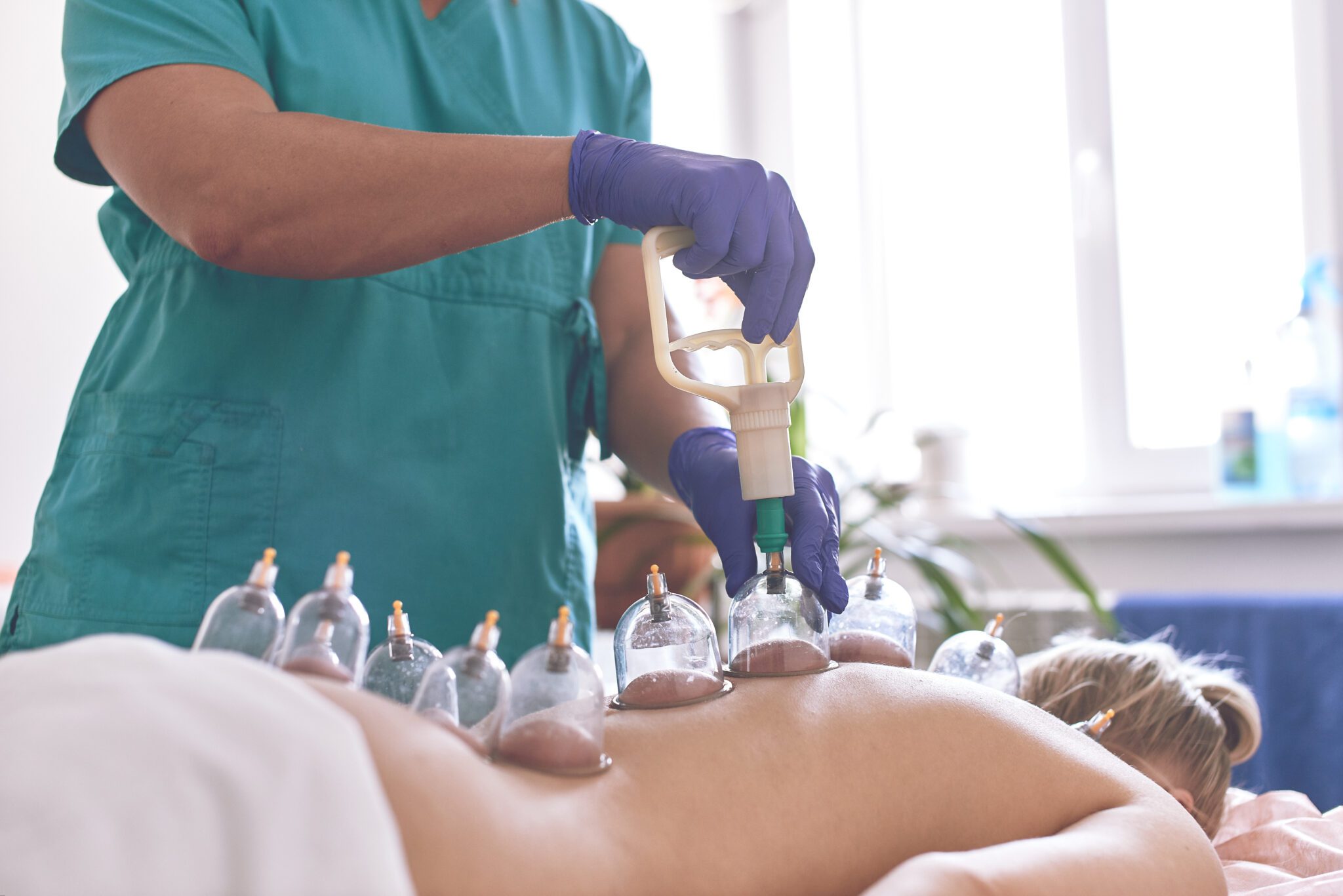 Before and After Cupping Therapy: What to Expect