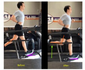 IMPACT Runner's Video Gait Analysis Testimonial