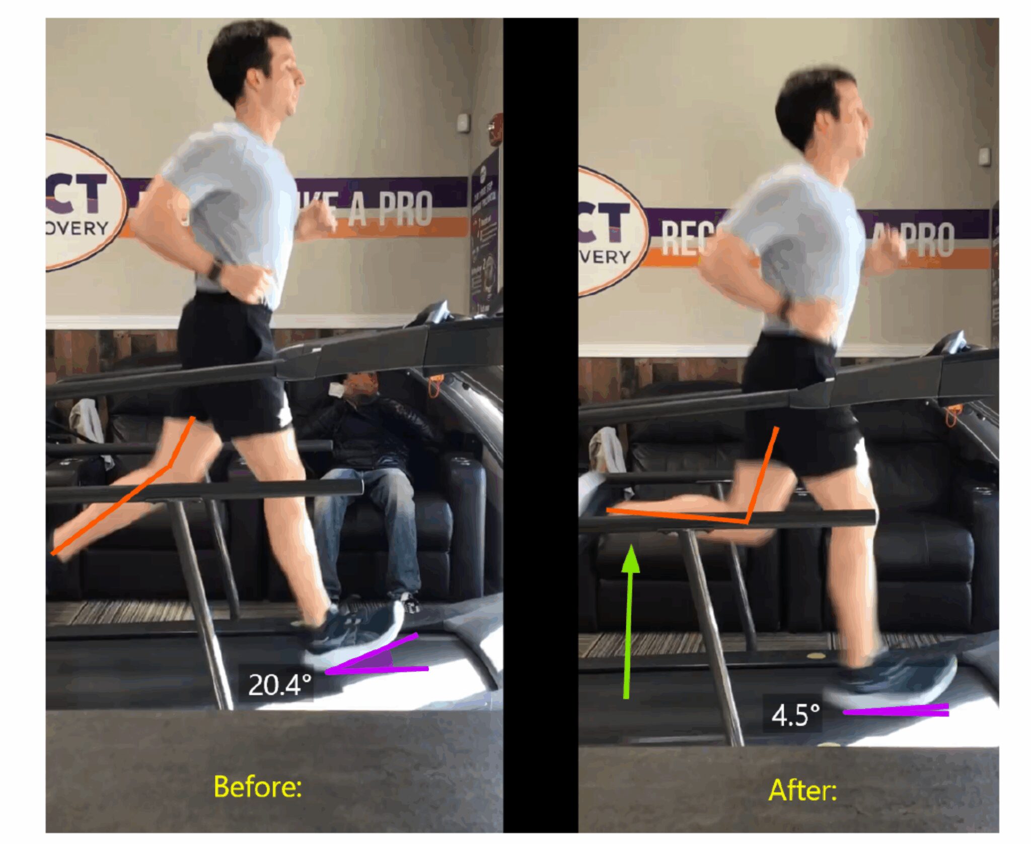 IMPACT Runner's Video Gait Analysis Testimonial