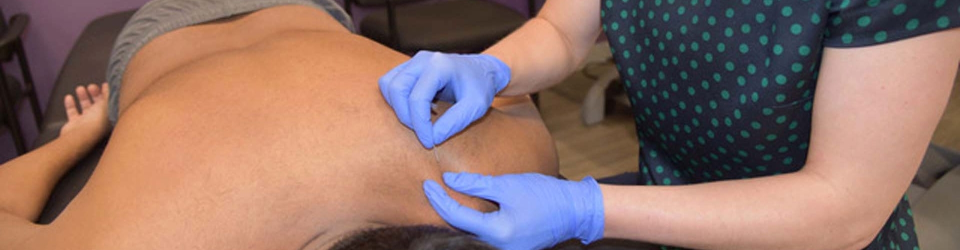 trigger-point-dry-needling-Impact-Physical-Therapy-Sport-Recovery-Champaign-Hinsdale-Chicago-Naperville-Oak-Lawn-Orland-Park-IL