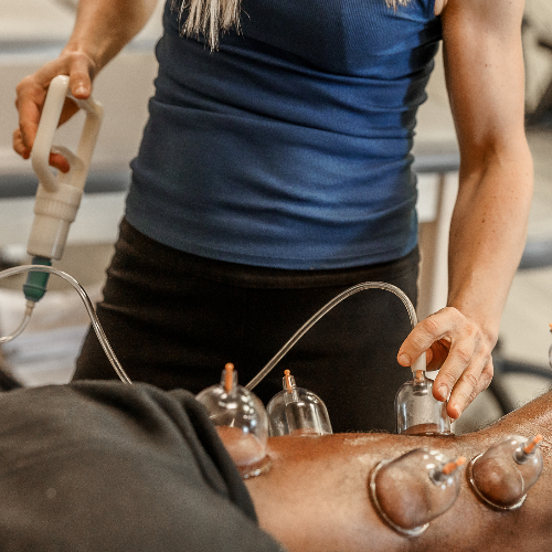 cupping-Physical-Therapy-Sport-Recovery-Oak-Lawn-IL